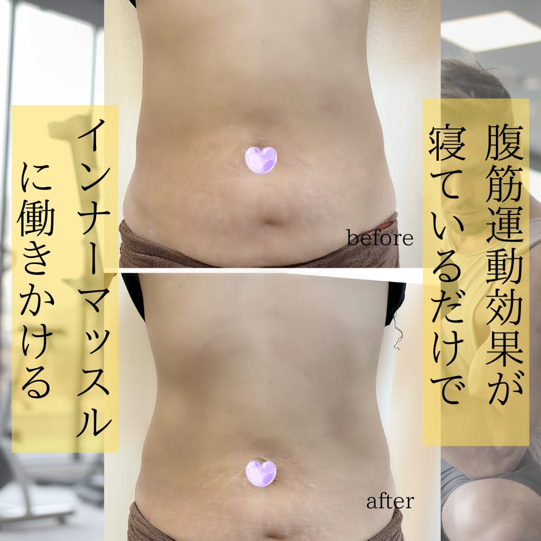 電磁パルス施術のビフォーアフター例