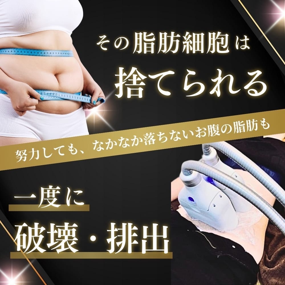 古河市ミエーレの痩身・脂肪冷却・ラジオ波・電磁パルス